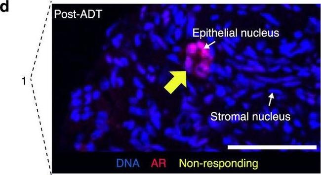 Rabbit IgG (H+L) Highly Cross-Adsorbed Secondary Antibody in Immunohistochemistry (Paraffin) (IHC (P))