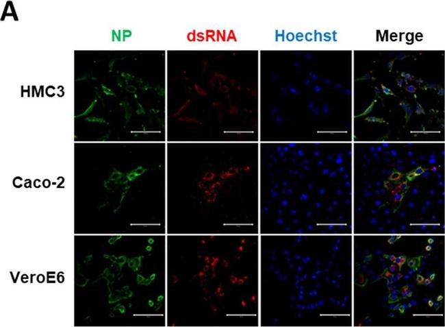 Rabbit IgG (H+L) Highly Cross-Adsorbed Secondary Antibody in Immunocytochemistry (ICC/IF)