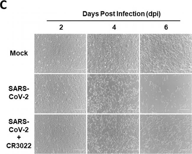 Rabbit IgG (H+L) Highly Cross-Adsorbed Secondary Antibody in Immunocytochemistry (ICC/IF)