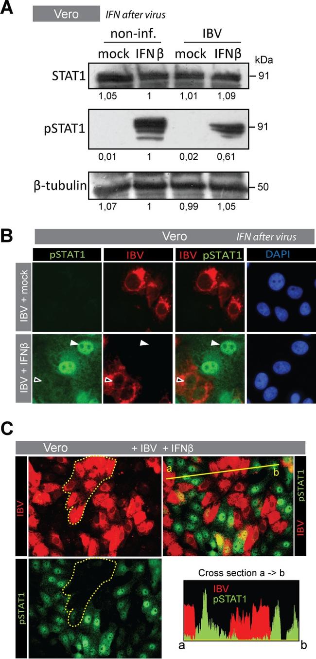 Phospho-STAT1 (Tyr701) Antibody