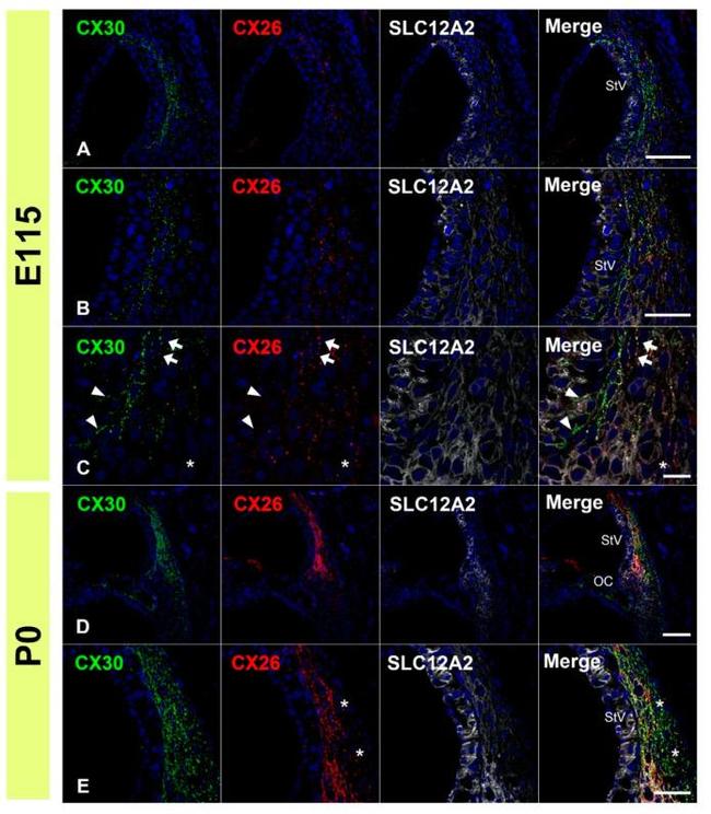 Connexin 26 Antibody in Immunohistochemistry (IHC)