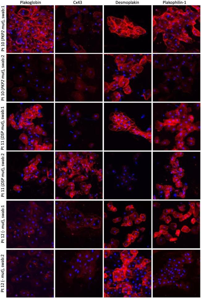 PKP1 Antibody in Immunocytochemistry (ICC/IF)