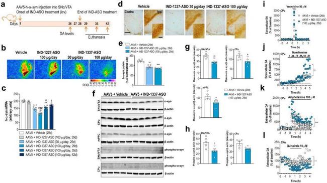 alpha Synuclein Antibody in Western Blot (WB)