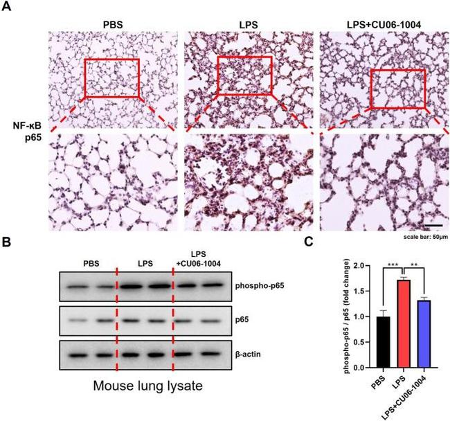 NFkB p65 Antibody in Immunohistochemistry (IHC)