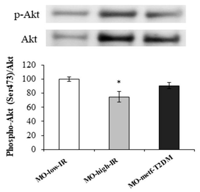 Phospho-AKT1 (Ser473) Antibody in Western Blot (WB)