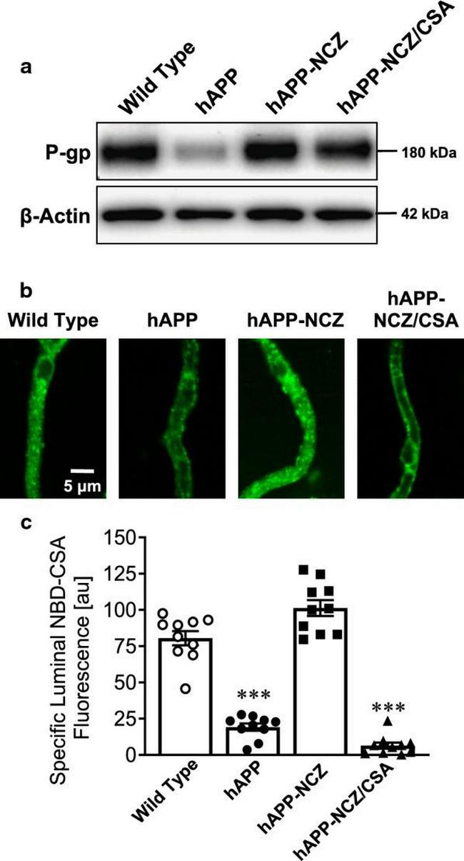 P-Glycoprotein Antibody in Western Blot (WB)