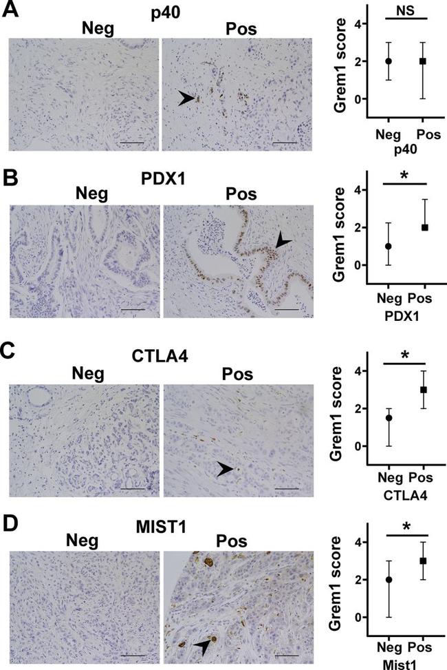 Mist1 Antibody in Immunohistochemistry (IHC)