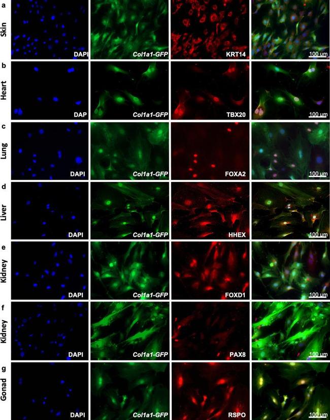 Cytokeratin 14 Antibody in Immunocytochemistry (ICC/IF)