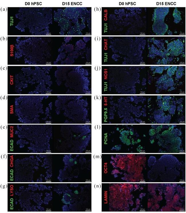 Serotonin Antibody in Immunocytochemistry (ICC/IF)