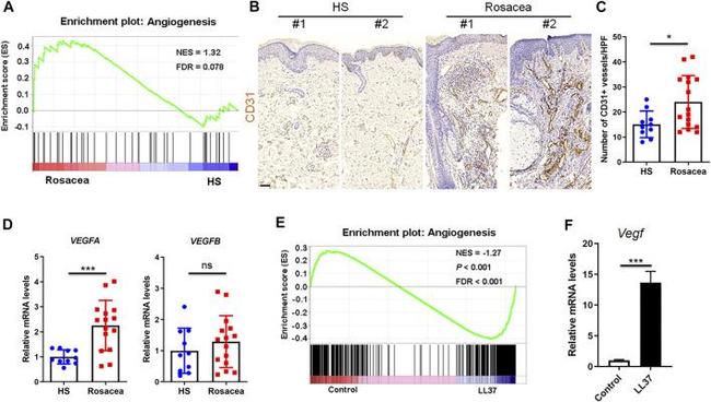 CD31 Antibody in Immunohistochemistry (IHC)