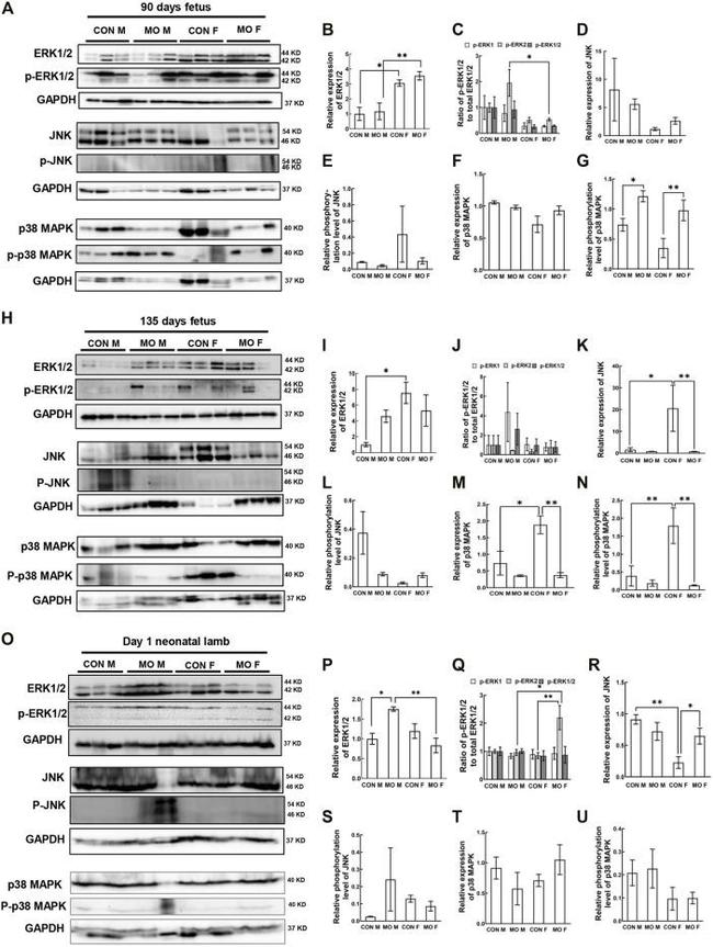 Phospho-p38 MAPK (Thr180, Tyr182) Antibody in Western Blot (WB)