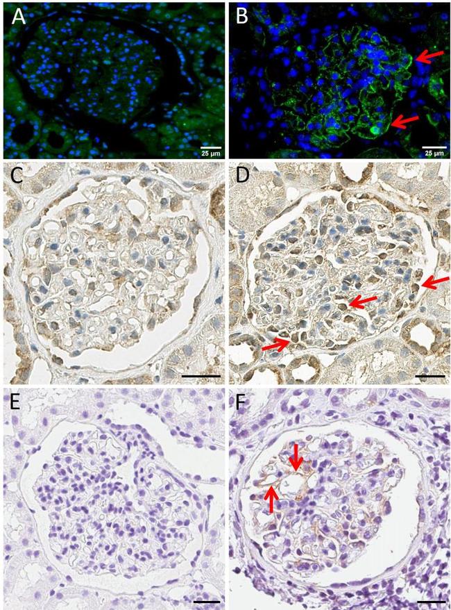 Axl Antibody in Immunohistochemistry (IHC)