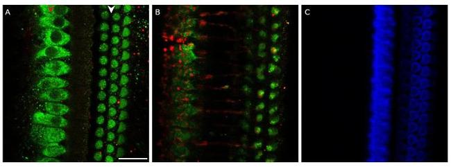 MYO7A Antibody in Immunohistochemistry (PFA fixed) (IHC (PFA))