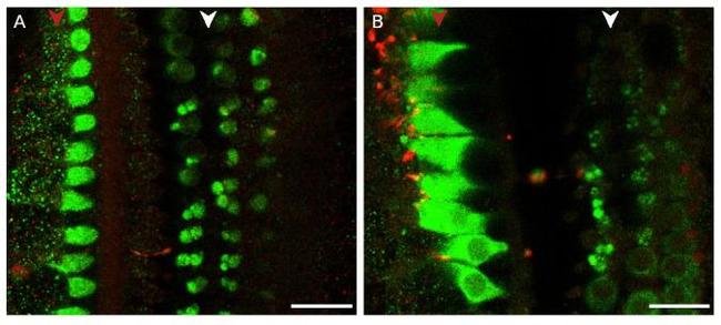 MYO7A Antibody in Immunohistochemistry (PFA fixed) (IHC (PFA))