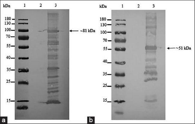 6x-His Tag Antibody in Western Blot (WB)