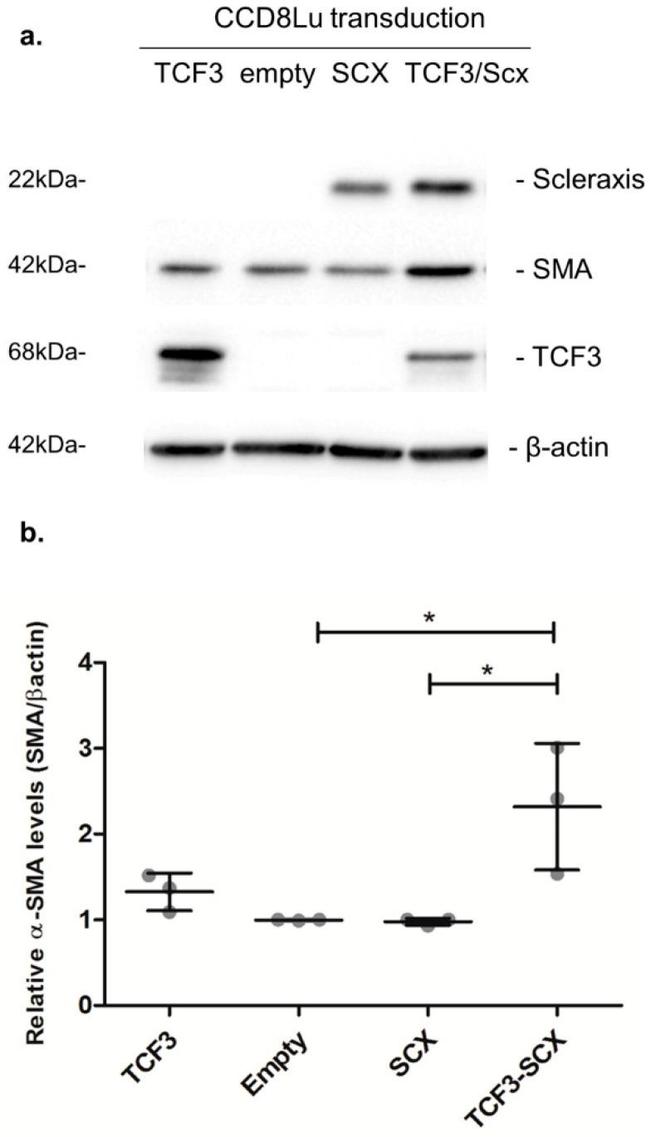 TCF3 Antibody in Western Blot (WB)