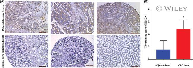 Endomucin Antibody in Immunohistochemistry (IHC)