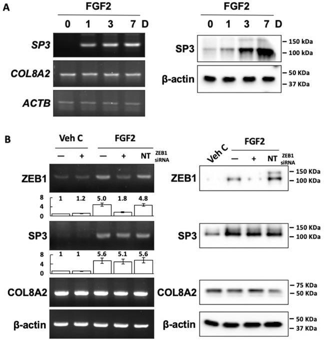 ZEB1 Antibody in Western Blot (WB)