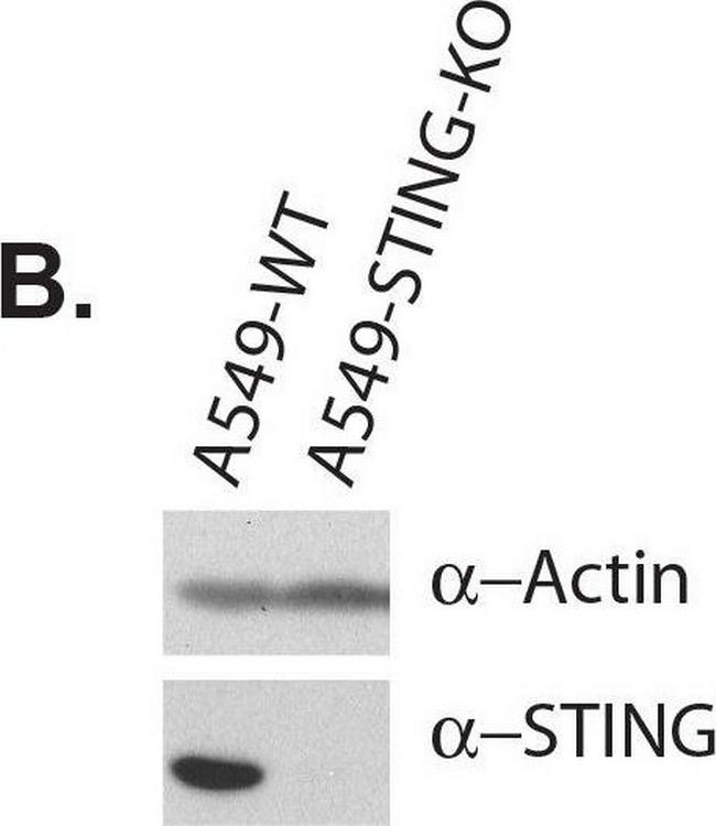 Rabbit IgG (H+L) Secondary Antibody in Western Blot (WB)