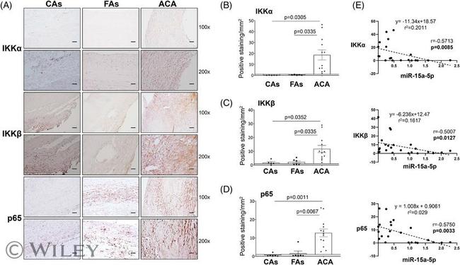 NFkB p65 Antibody in Immunohistochemistry (Paraffin) (IHC (P))