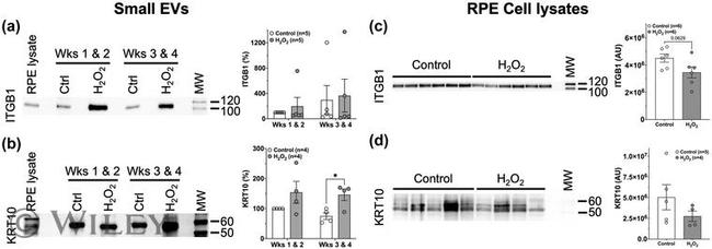 Cytokeratin 10 Antibody in Western Blot (WB)