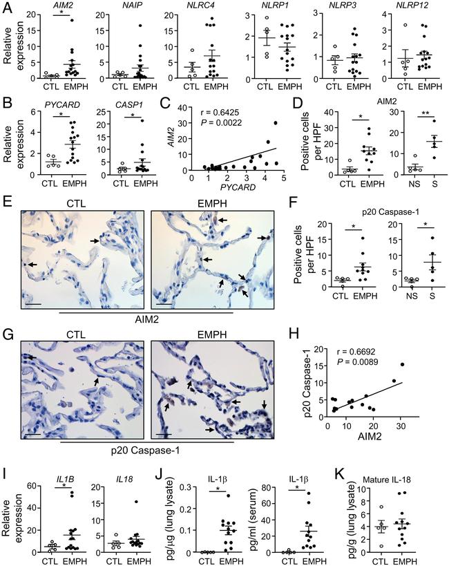 Caspase 1 (Cleaved Asp210) Antibody in Immunohistochemistry (Paraffin) (IHC (P))