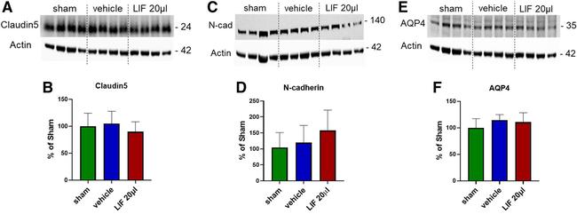 Aquaporin 4 Antibody in Western Blot (WB)