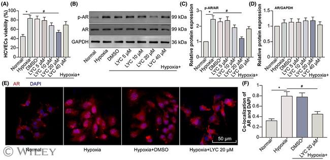 Androgen Receptor Antibody in Western Blot (WB)