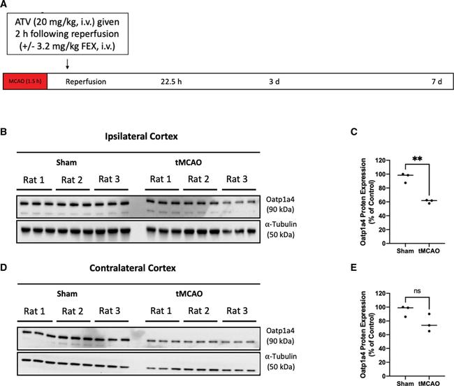 OATP1 Antibody in Western Blot (WB)