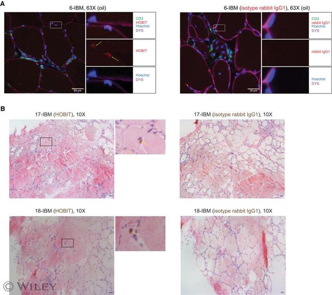 ZNF683 Antibody in Immunohistochemistry (Paraffin) (IHC (P))