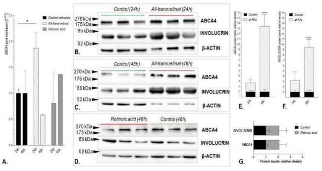 Involucrin Antibody in Western Blot (WB)