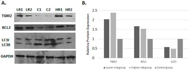 TGM2 Antibody in Western Blot (WB)