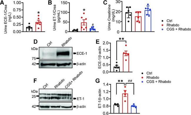 ECE1 Antibody in Western Blot (WB)