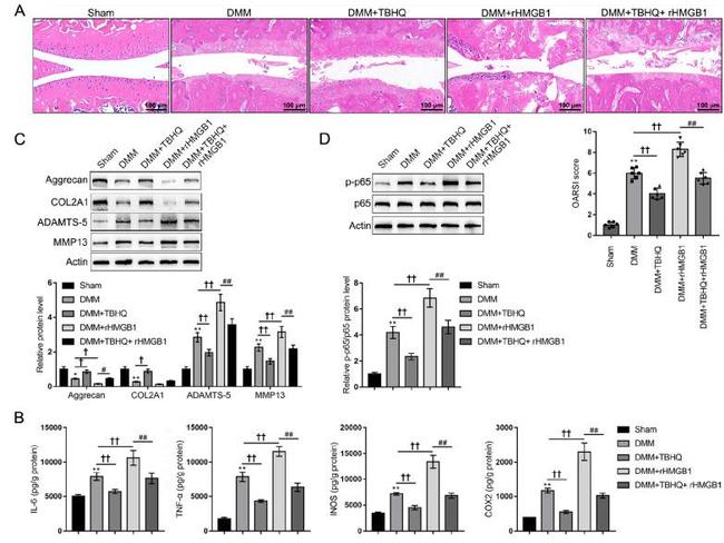 Collagen II Antibody in Western Blot (WB)