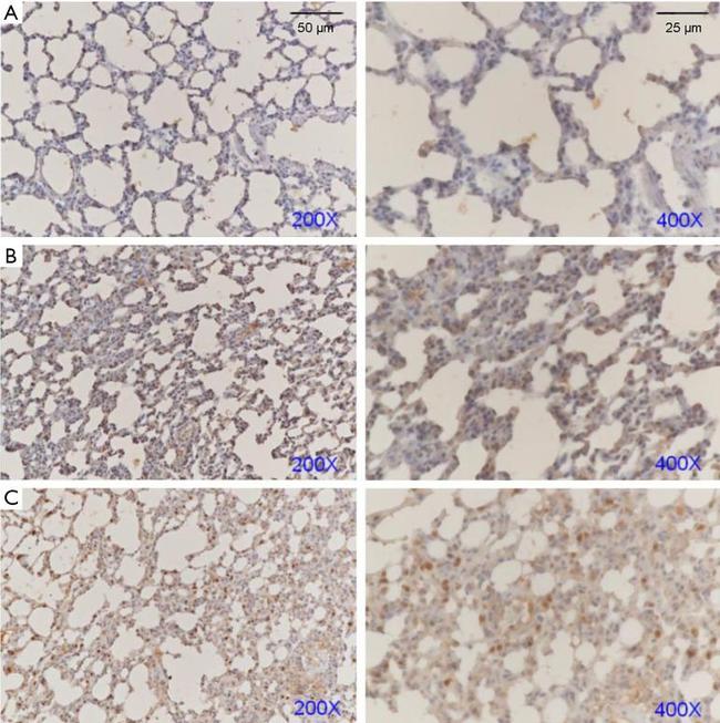 NOTCH1 Antibody in Immunohistochemistry (Paraffin) (IHC (P))