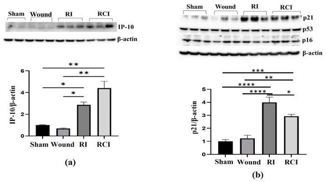 p16INK4a Antibody in Western Blot (WB)