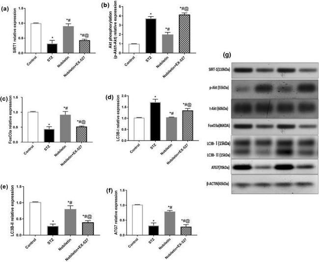 FOXO3A Antibody in Western Blot (WB)