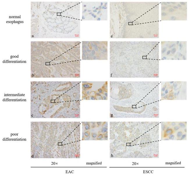 GPR30 Antibody in Immunohistochemistry (IHC)