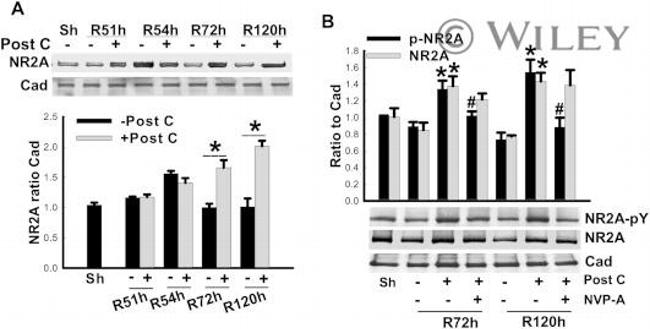 Phosphotyrosine Antibody in Western Blot (WB)