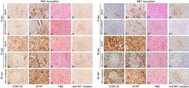 TACR1 Antibody in Immunohistochemistry (Paraffin) (IHC (P))