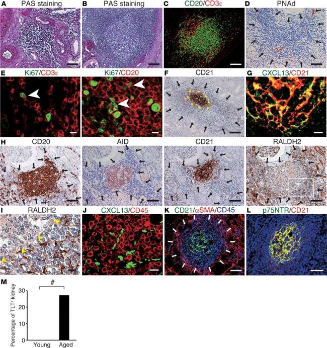 Ki-67 Antibody in Immunohistochemistry (Paraffin), Immunohistochemistry (PFA fixed) (IHC (P), IHC (PFA))