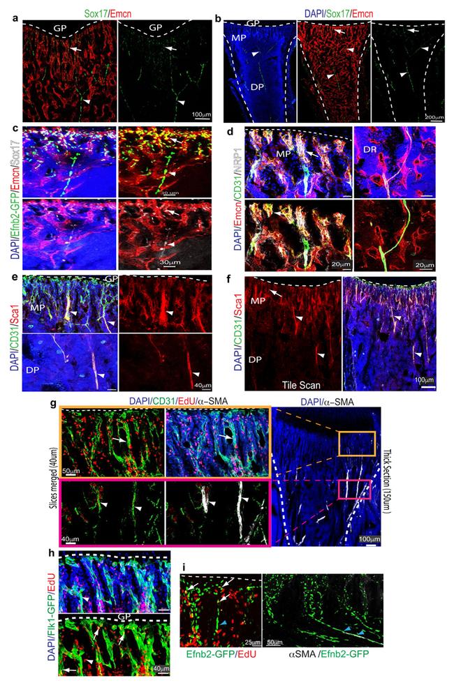 SOX17 Antibody in Immunocytochemistry (ICC/IF)