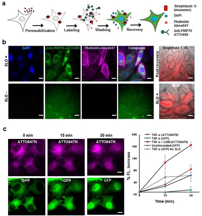 GFP Antibody in Immunocytochemistry (ICC/IF)