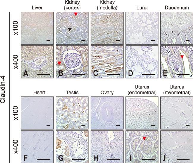 Claudin 4 Antibody in Immunohistochemistry (IHC)