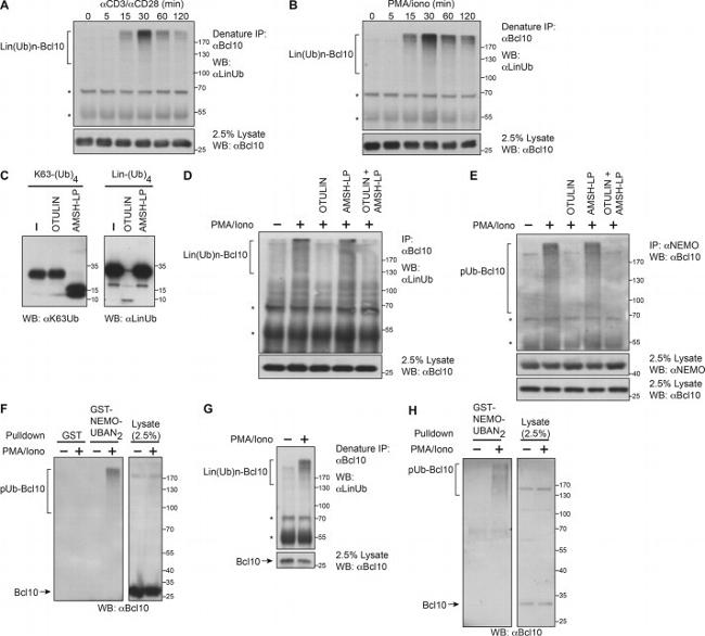 Ub-K63 Antibody in Western Blot (WB)