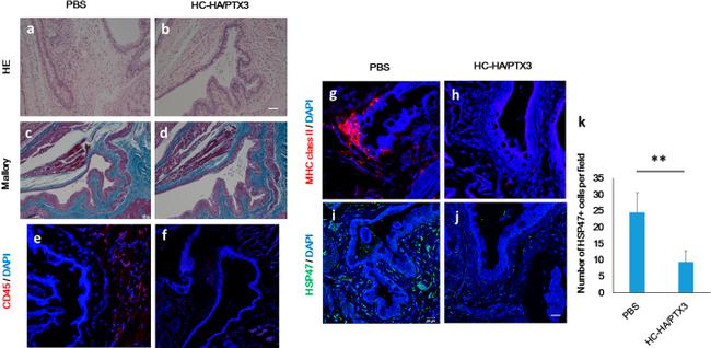 CD45 Antibody in Immunohistochemistry (IHC)