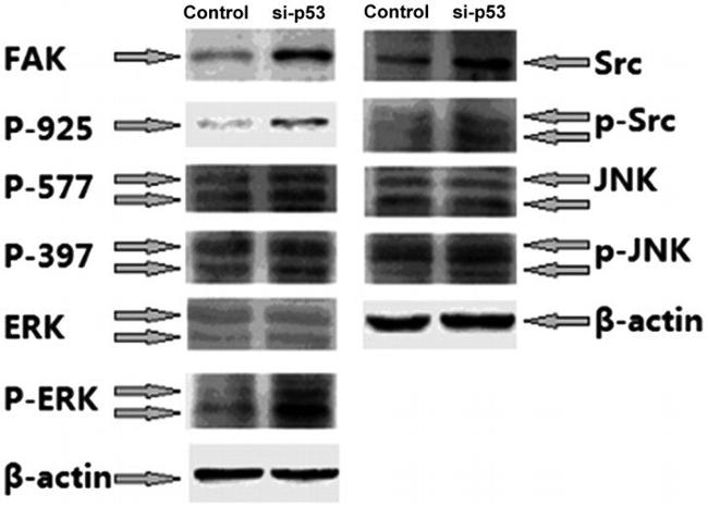 Phospho-FAK (Tyr925) Antibody in Western Blot (WB)