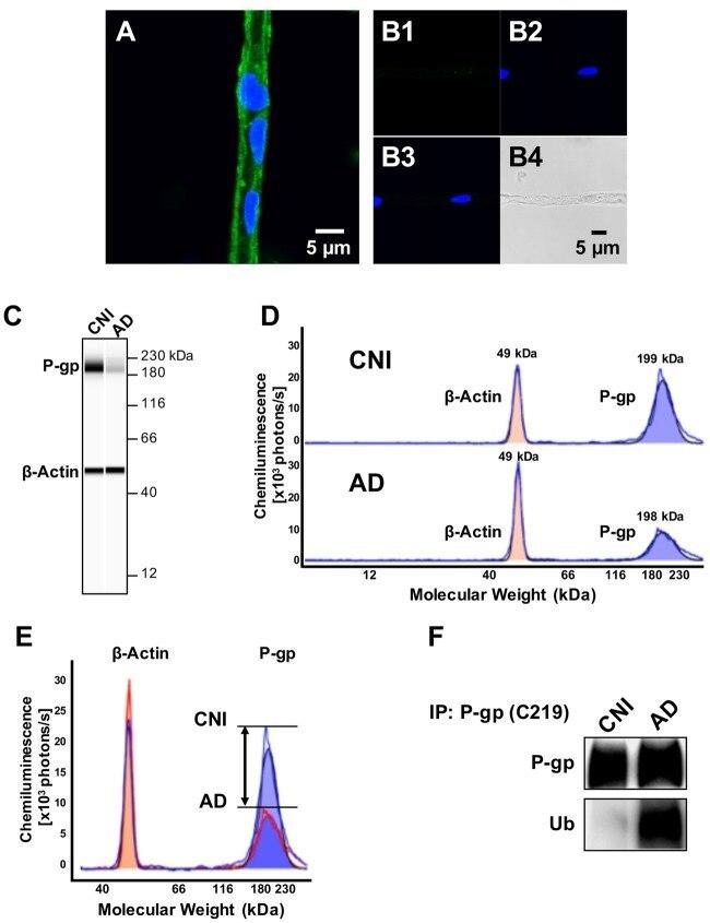 P-Glycoprotein Antibody in Immunohistochemistry (IHC)