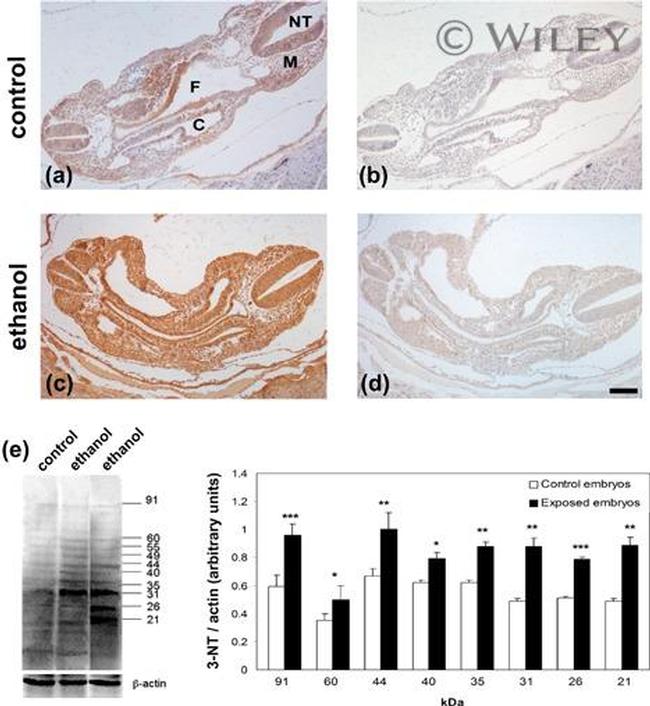 Nitrotyrosine Antibody in Immunohistochemistry (IHC)