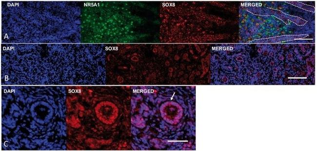 NR5A1 Antibody in Immunohistochemistry (IHC)